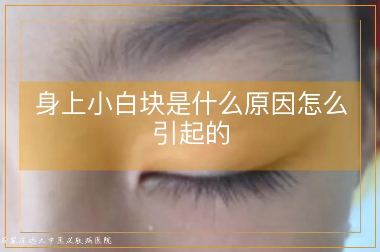 身上小白块是什么原因怎么引起的