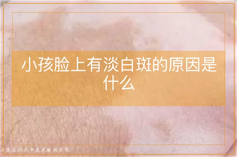 小孩脸上有淡白斑的原因是什么