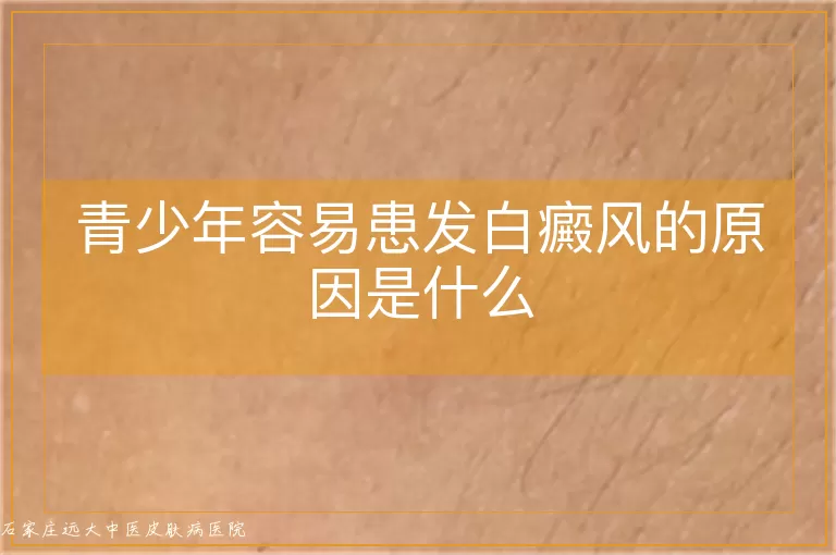 青少年容易患发白癜风的原因是什么