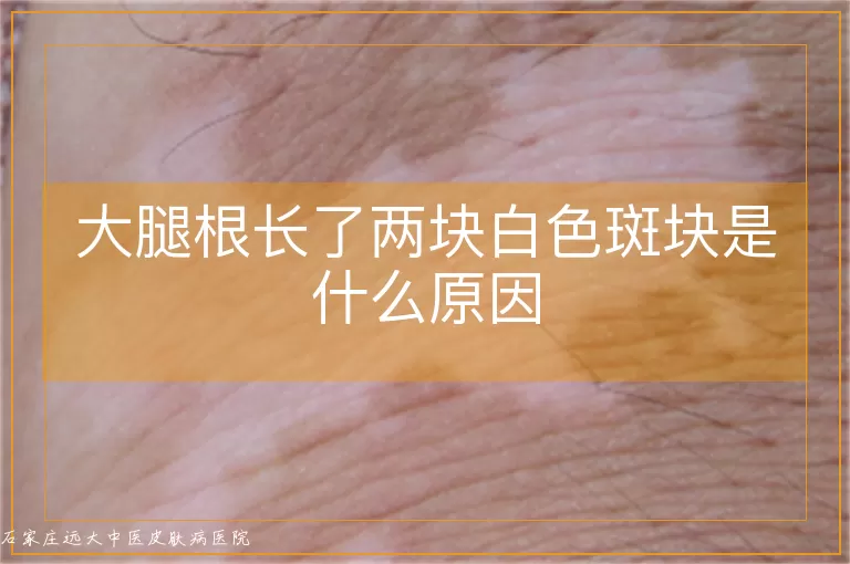 大腿根长了两块白色斑块是什么原因