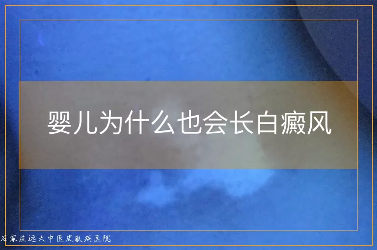 婴儿为什么也会长白癜风