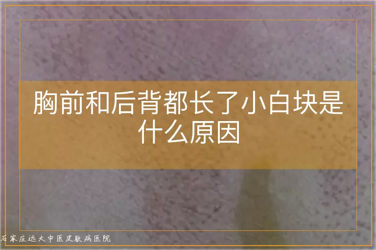 胸前和后背都长了小白块是什么原因