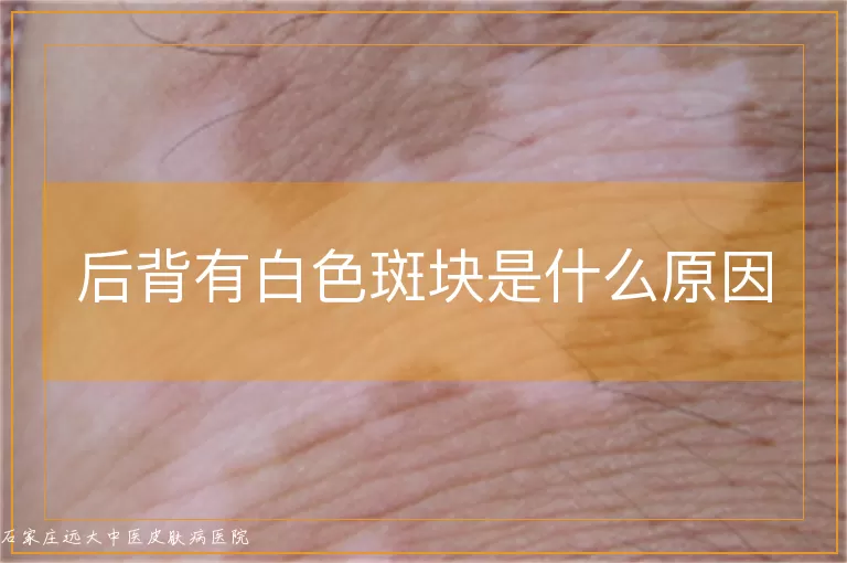 后背有白色斑块是什么原因