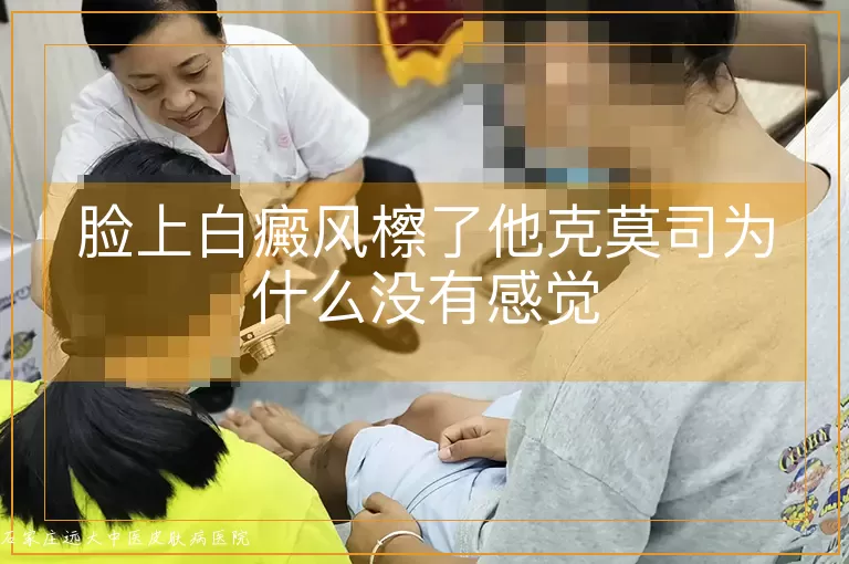 脸上白癜风檫了他克莫司为什么没有感觉