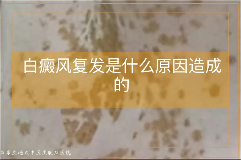 白癜风复发是什么原因造成的