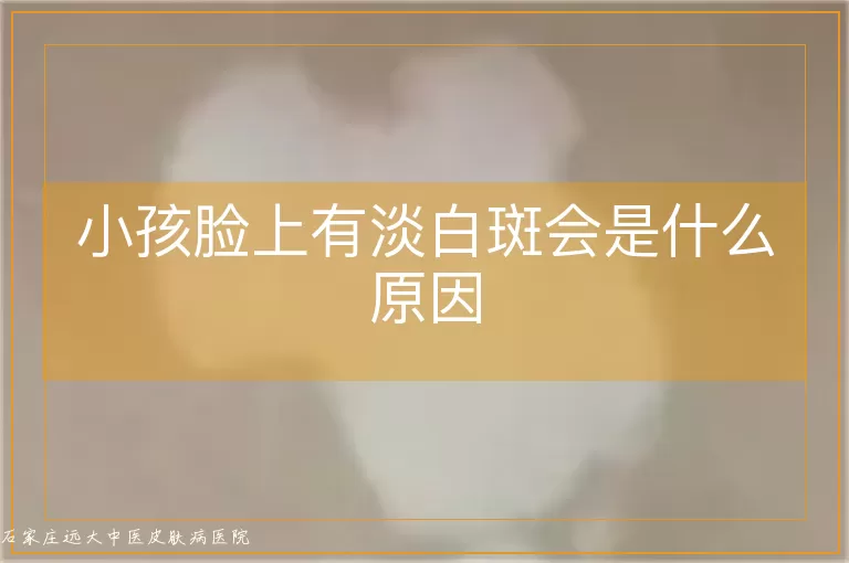 小孩脸上有淡白斑会是什么原因