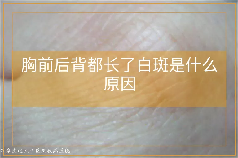 胸前后背都长了白斑是什么原因