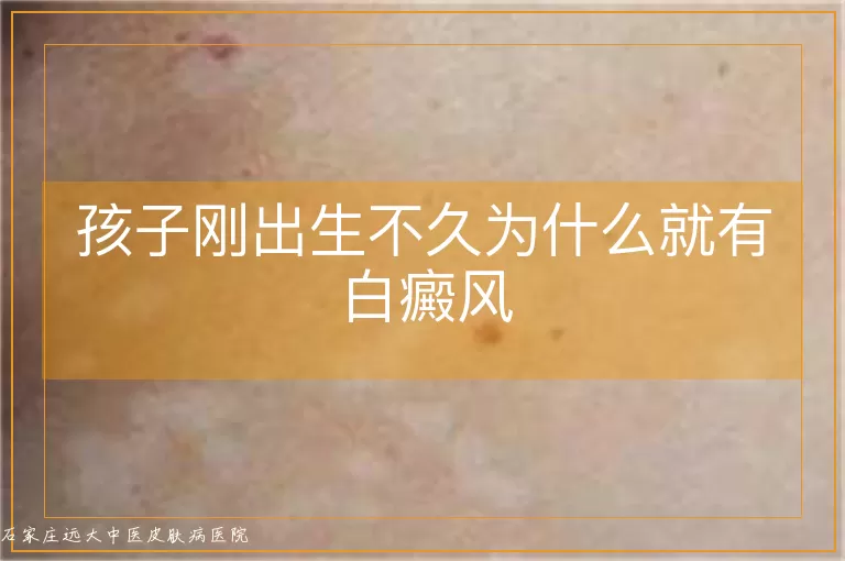 孩子刚出生不久为什么就有白癜风