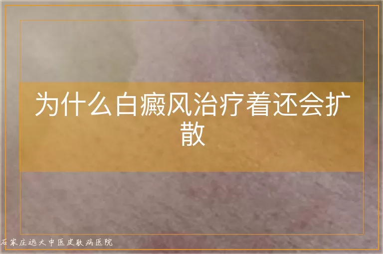 为什么白癜风治疗着还会扩散