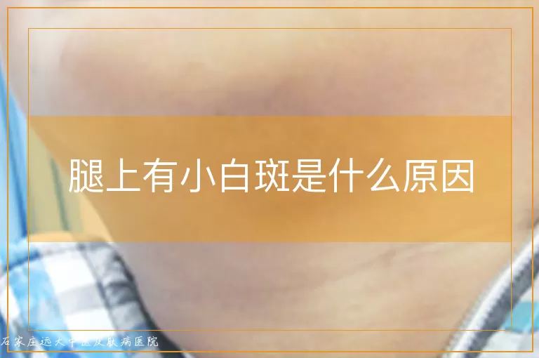 腿上有小白斑是什么原因