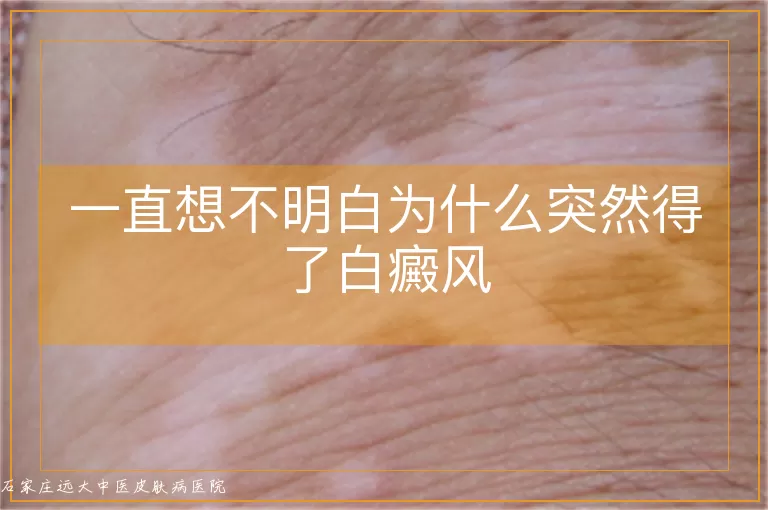 一直想不明白为什么突然得了白癜风