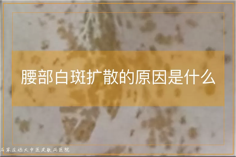 腰部白斑扩散的原因是什么