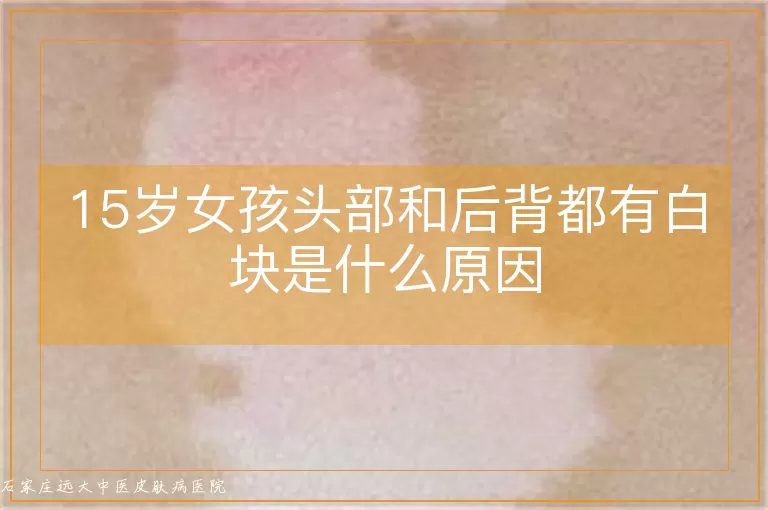 15岁女孩头部和后背都有白块是什么原因