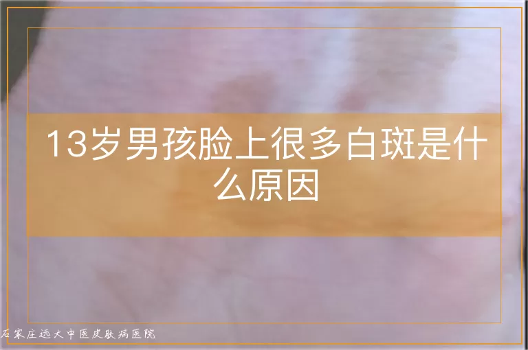 13岁男孩脸上很多白斑是什么原因