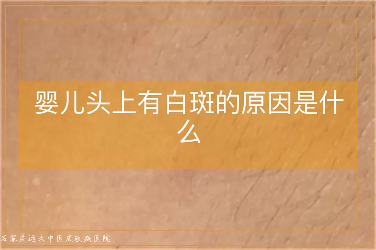 婴儿头上有白斑的原因是什么