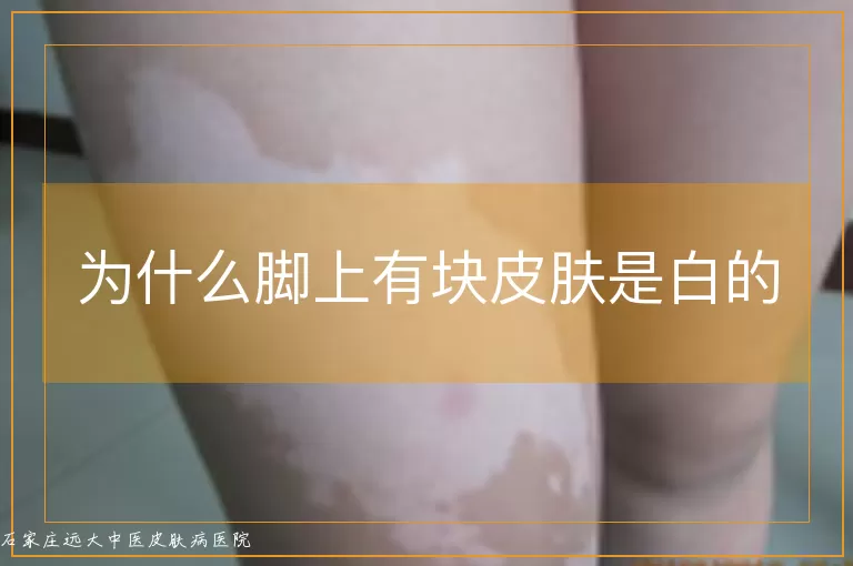 为什么脚上有块皮肤是白的