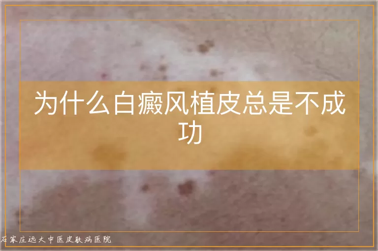 为什么白癜风植皮总是不成功