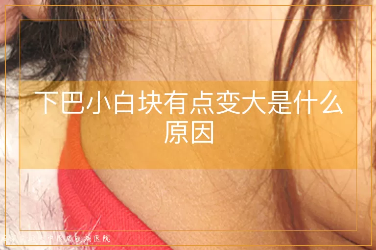 下巴小白块有点变大是什么原因
