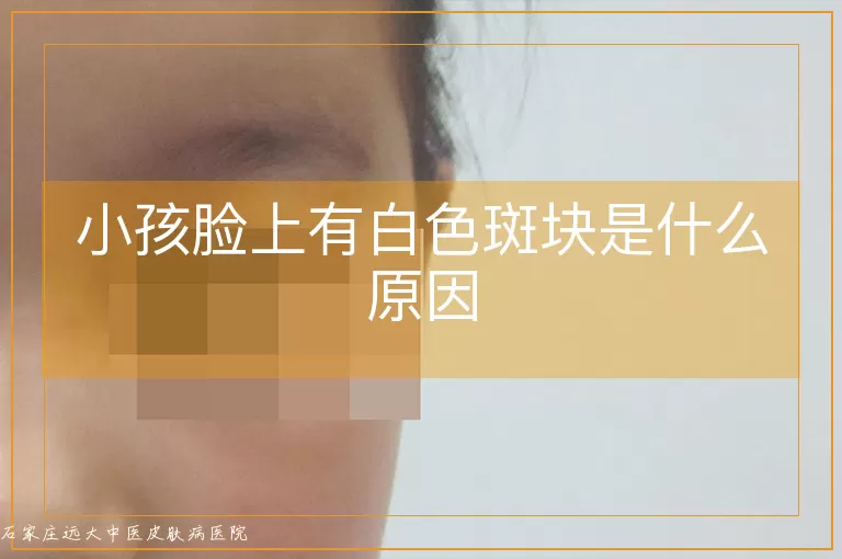 小孩脸上有白色斑块是什么原因