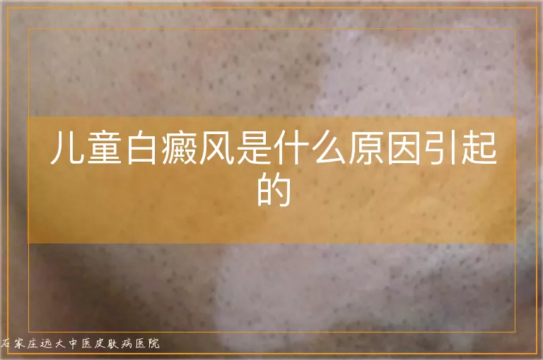 儿童白癜风是什么原因引起的