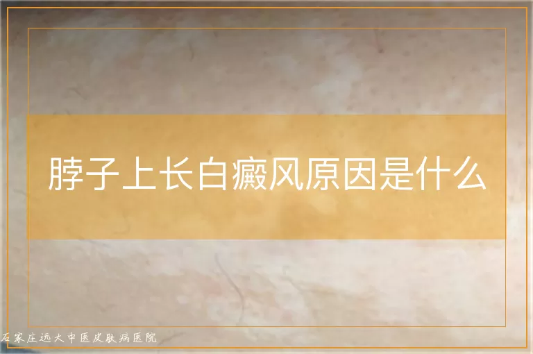 脖子上长白癜风原因是什么
