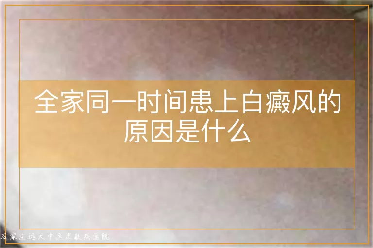 全家同一时间患上白癜风的原因是什么