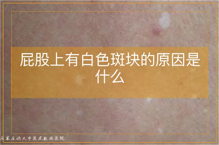 屁股上有白色斑块的原因是什么