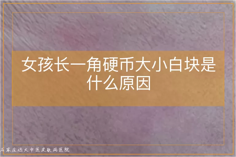 女孩长一角硬币大小白块是什么原因