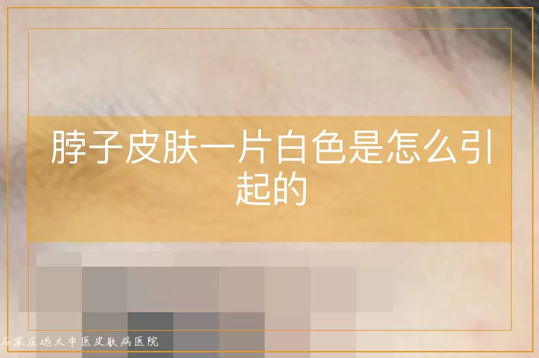 脖子皮肤一片白色是怎么引起的