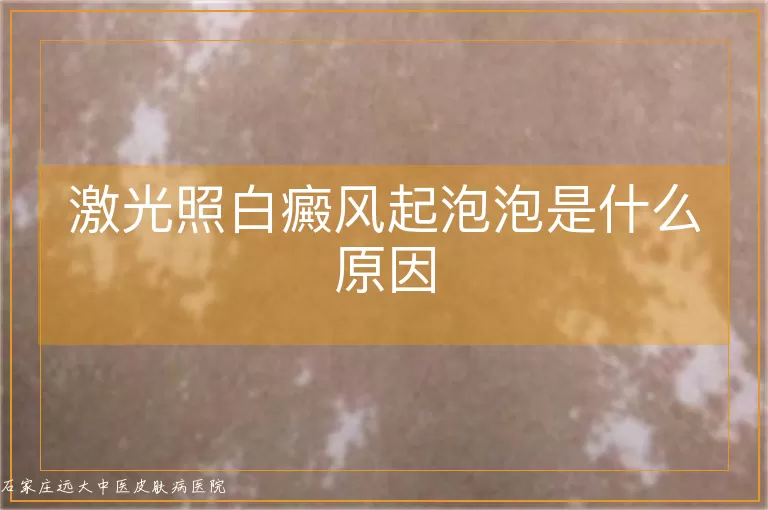 激光照白癜风起泡泡是什么原因
