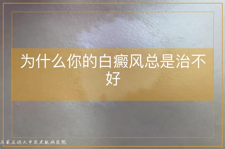 为什么你的白癜风总是治不好