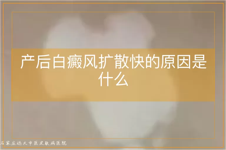 产后白癜风扩散快的原因是什么