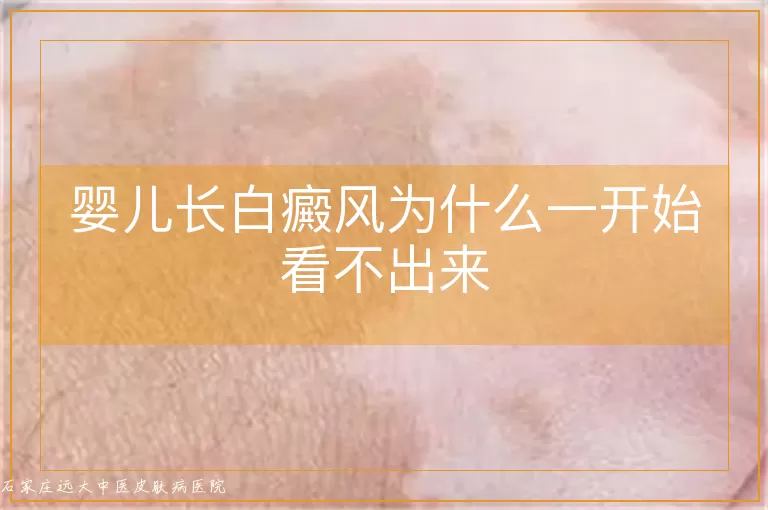 婴儿长白癜风为什么一开始看不出来