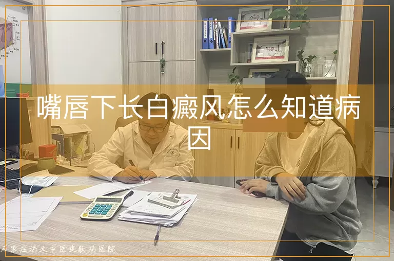 嘴唇下长白癜风怎么知道病因