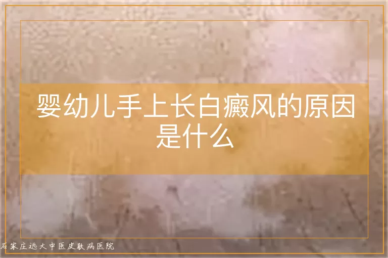 婴幼儿手上长白癜风的原因是什么