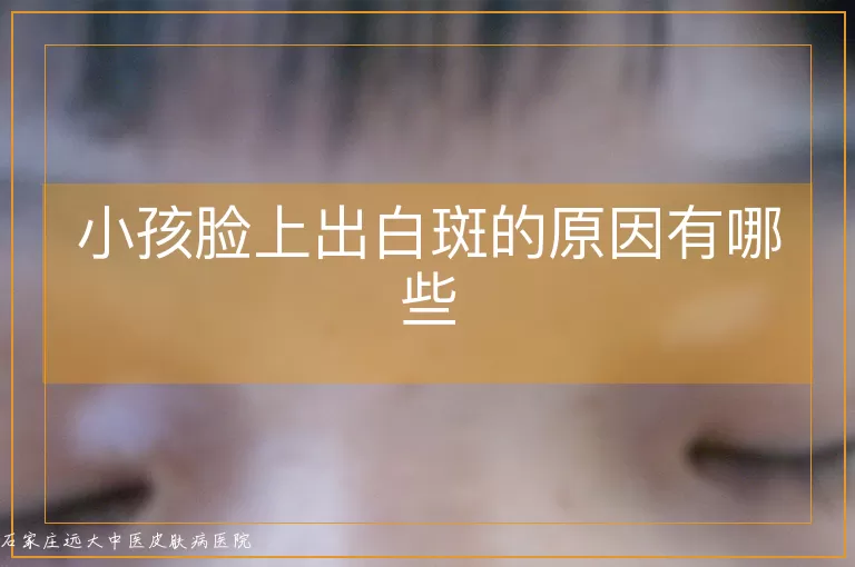 小孩脸上出白斑的原因有哪些