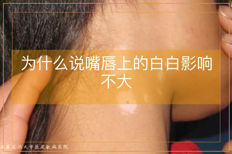 为什么说嘴唇上的白白影响不大