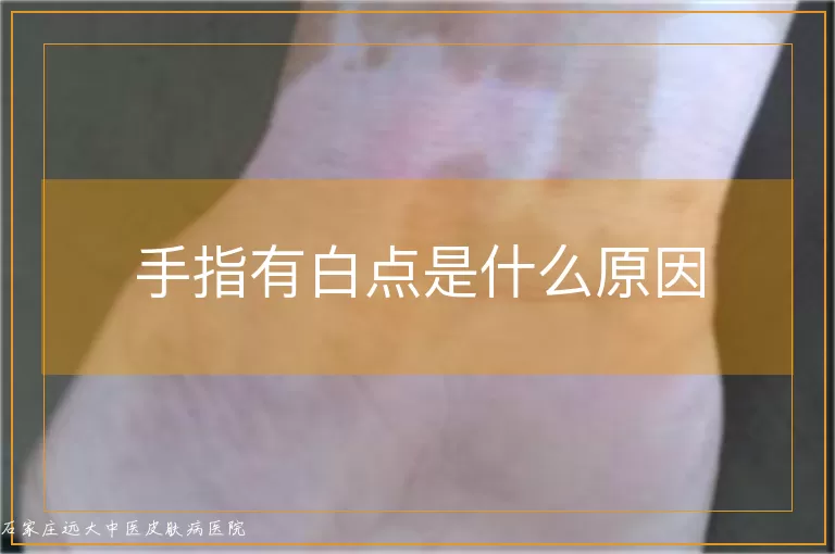 手指有白点是什么原因