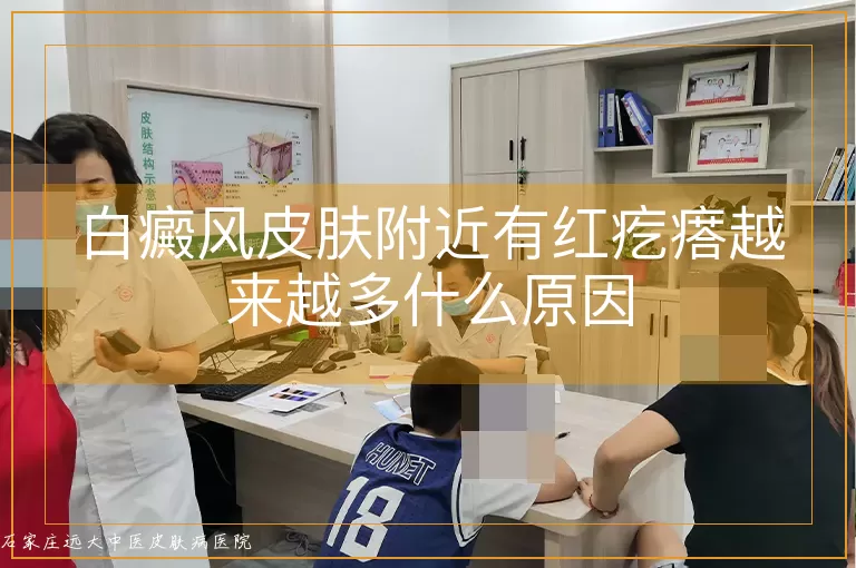 白癜风皮肤附近有红疙瘩越来越多什么原因