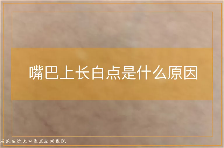 嘴巴上长白点是什么原因