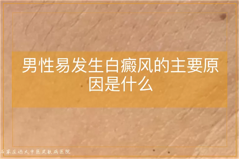 男性易发生白癜风的主要原因是什么