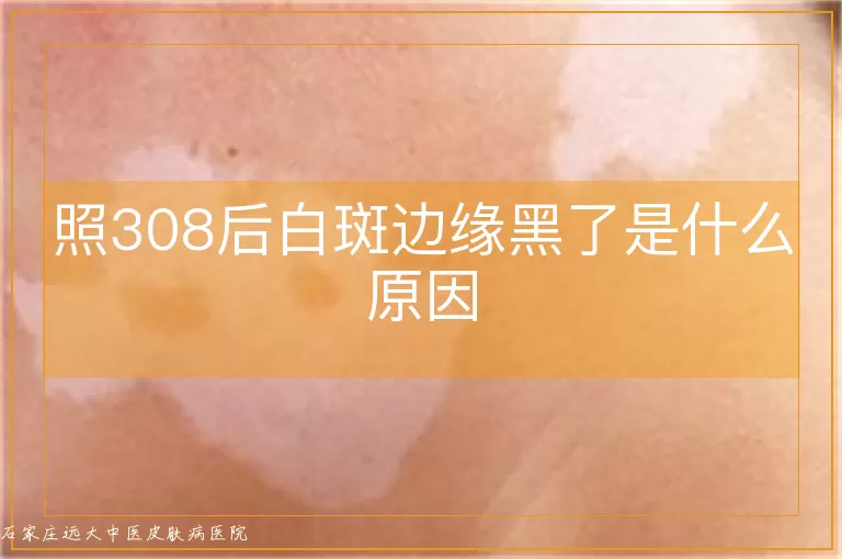 照308后白斑边缘黑了是什么原因