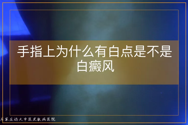 手指上为什么有白点是不是白癜风