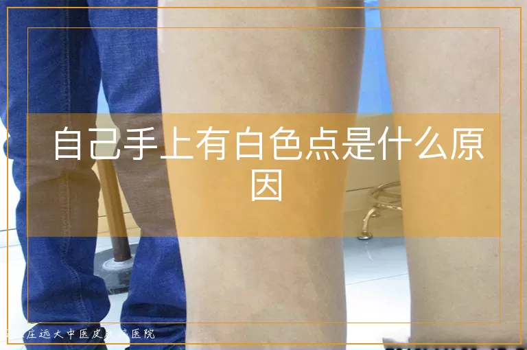自己手上有白色点是什么原因