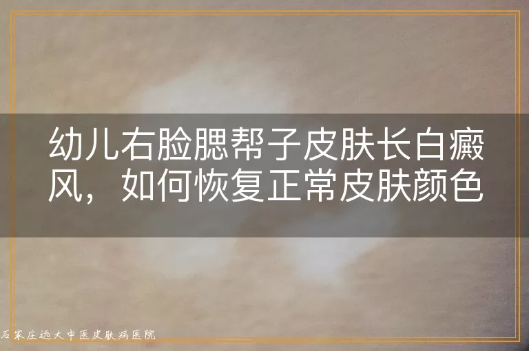 幼儿右脸腮帮子皮肤长白癜风，如何恢复正常皮肤颜色？