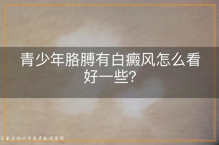 青少年胳膊有白癜风怎么看好一些？