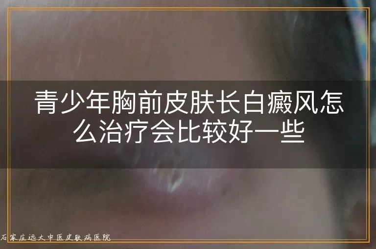 青少年胸前皮肤长白癜风怎么治疗会比较好一些