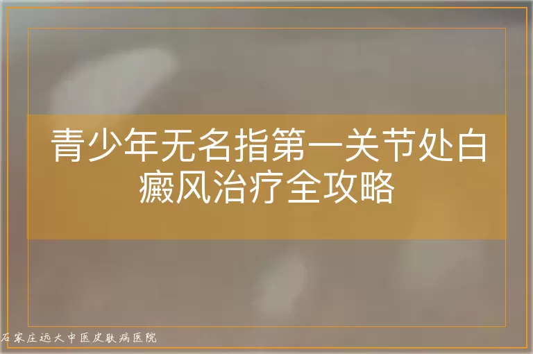 青少年无名指第一关节处白癜风治疗全攻略