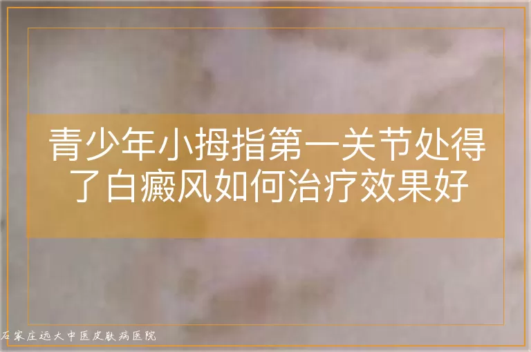 青少年小拇指第一关节处得了白癜风如何治疗效果好