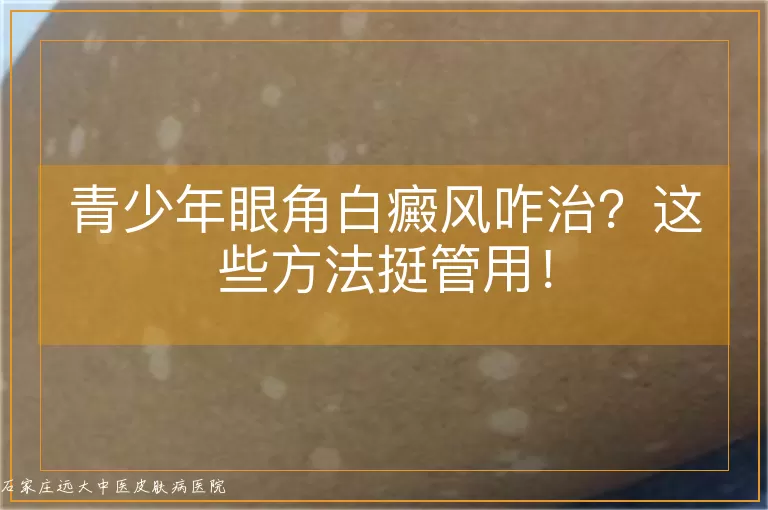 青少年眼角白癜风咋治?这些方法挺管用!